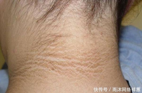 医生|十岁小男孩脖子一圈发黑洗不掉,听了医生的话后,家长们都笑了