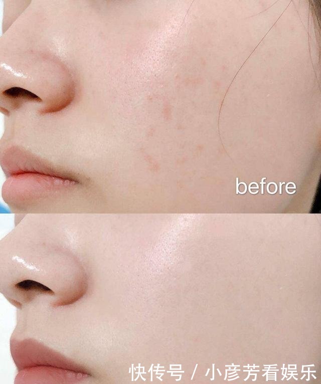 快速提高皮肤滑嫩饱满度,以油养肤绝对可