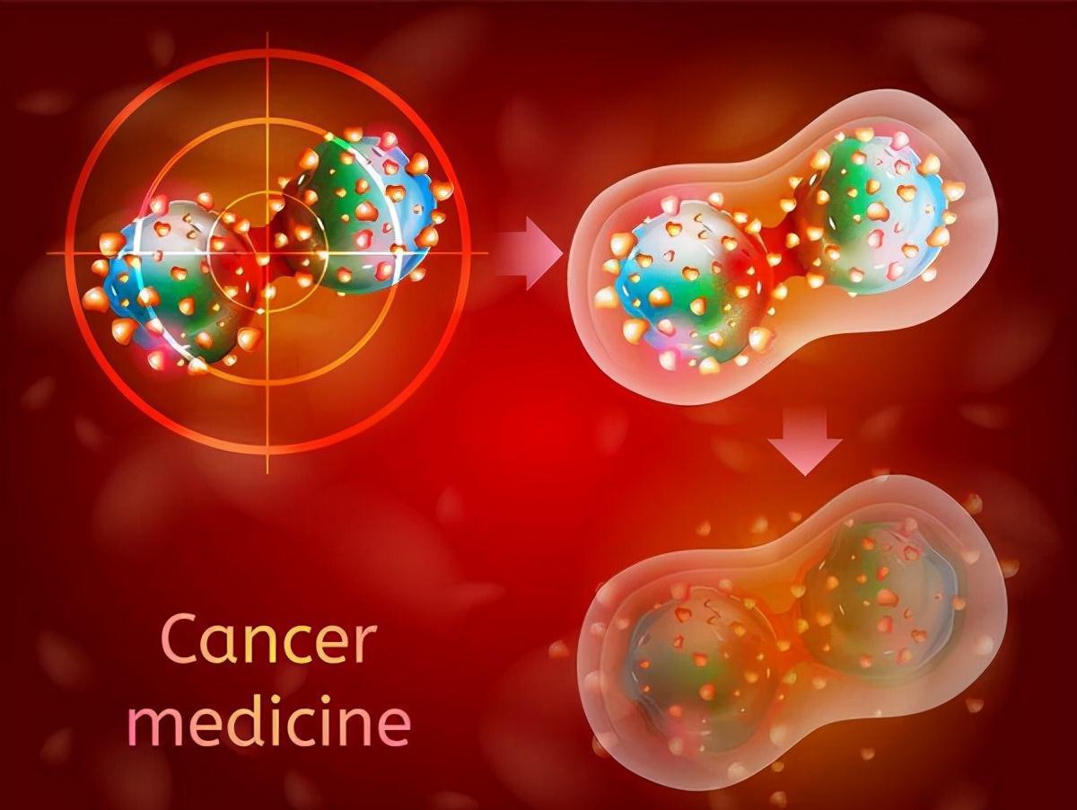 癌症患者|癌症易转移?想要防止复发转移,请记住以下5点