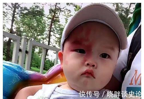 小女孩|宝宝的胎记怎么来的?产科医生:孕期这2种行为易长胎记,要避开