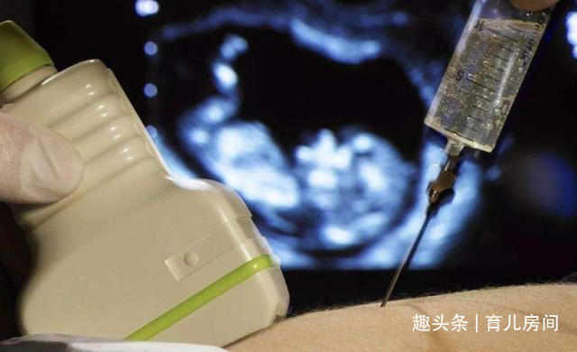 准确率|如今“唐氏宝宝”多了起来,诱因多半在于父母,这3种孕妈要小心