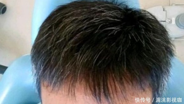 民间一个土秘方,不管白发多严重,让你从此告别染发,存起来