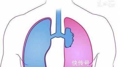 淋巴结|肺癌早期也是有迹可循的,身体出现这5个异常,还请及时就诊检查!