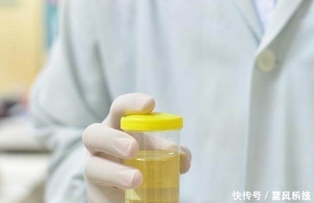 肝脏出现|“蹲厕所”时,若没有3种“现象”,恭喜,你的肝脏还不错