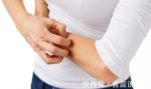 小痣|癌症来临时,皮肤会出现4个变化,希望你可以及时知晓