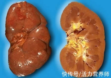 机体|不痛不痒，为什么还能查出癌症？这4种看似没感觉的症状才最危险