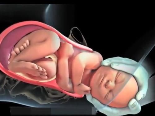 过程|顺产的全过程到底是怎样的,生而为人需了解,请勿泪奔