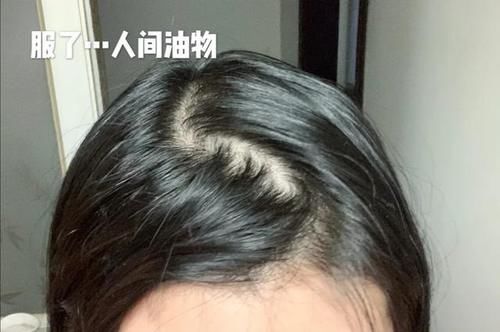 头发经常出油看上去很邋遢？女生做到这些，不用每天洗头也很清爽