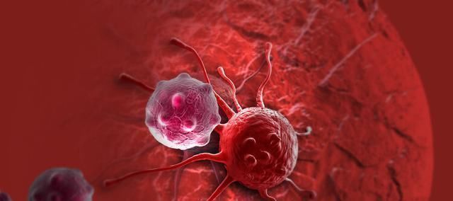 癌症|60岁以后是癌症的爆发期，原因无非就两个，家有老人的请注意