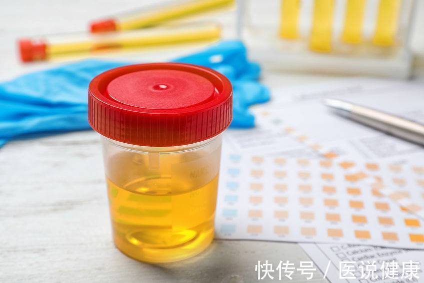 胆汁|肝功能受损时,身体会频繁出现3个症状,发现后,需及时检查