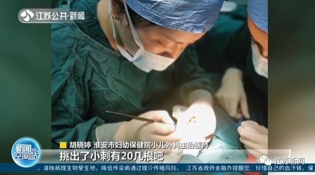 女童|3岁女童一掌拍在仙人球上,家人处理方式让她的手肿成“小熊掌”