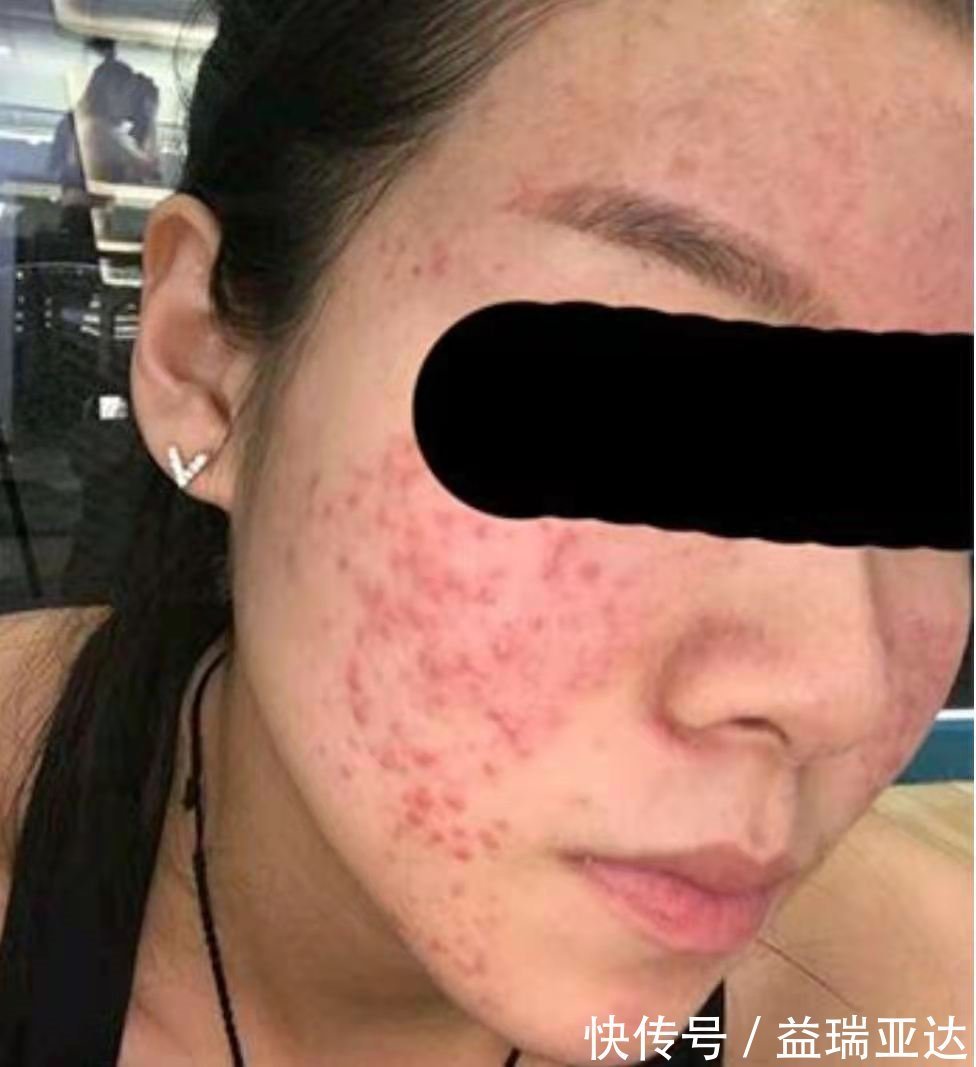 防腐剂|如何正确的选购洗面奶 洗面奶的原理和作用待到底是什么？