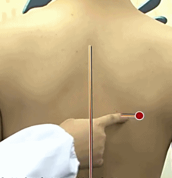 回事|查3次心脏都没问题呀，老胸痛，怎么回事？告诉你也许问题在这里