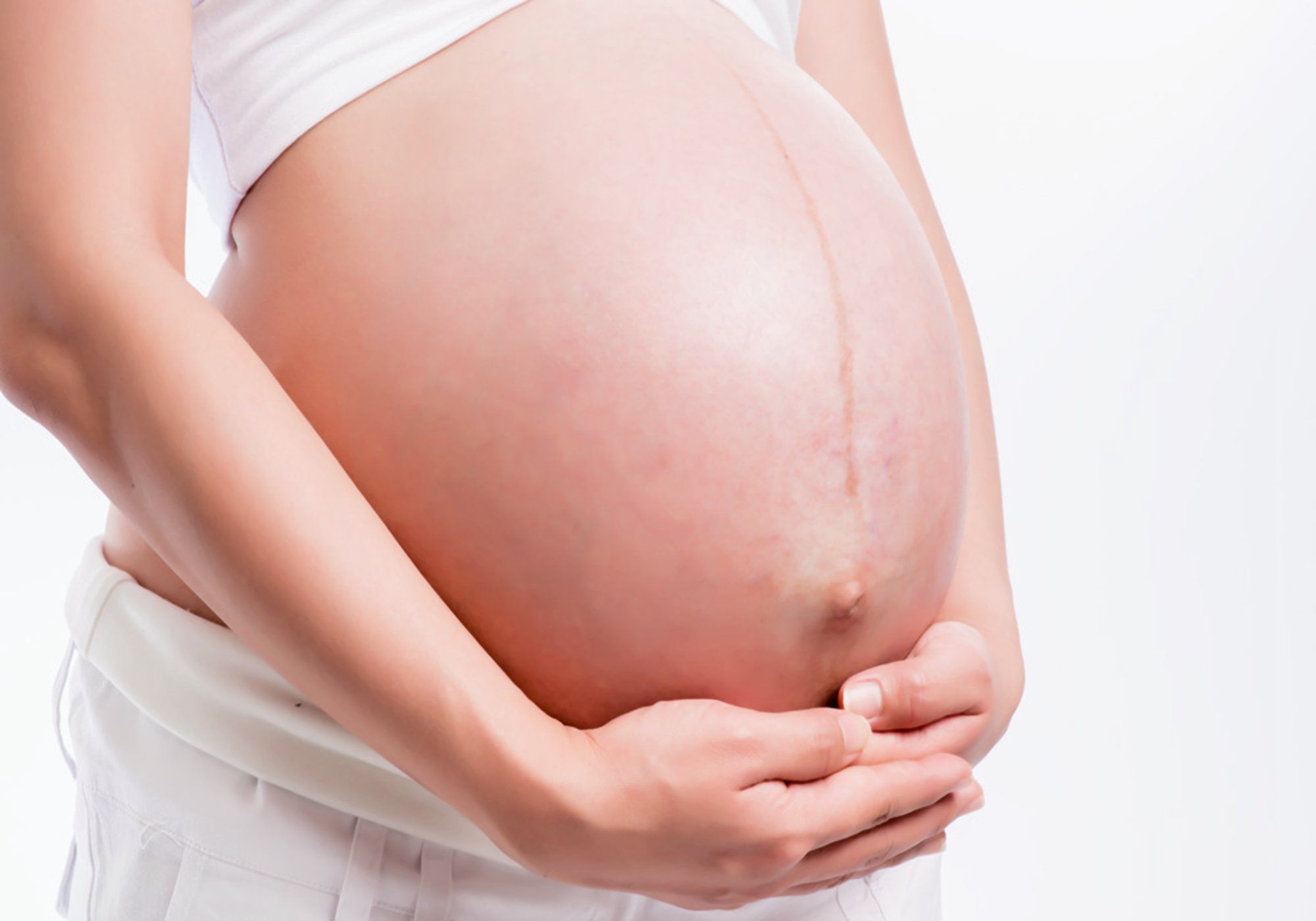 双胞胎|姐姐在腹中被弟弟“吸收”,化为胎记印在了弟弟腿上,爱的胎记