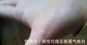 青筋|手掌上这块肉，一看就知道身体好不好！没事经常搓一搓，宣肺强心