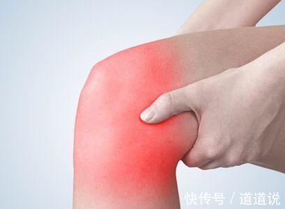 炎症|风湿性关节炎的几种表现