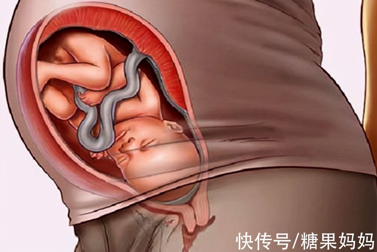 睡眠质量|胎宝“入盆”后,准妈妈的表现被误以为快生了,家人要多加小心