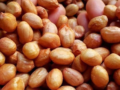 脂溢性皮炎|女孩子体重过百，3物当“零食”放开吃，一个月，体重或会悄悄降到2位数