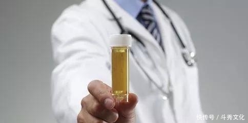 糖尿病人尿中有泡沫,两个+专家谈治疗方案
