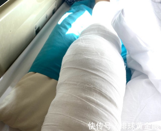 王辰玥|江苏女排名将晒出手术照!曾是联赛拦网王,2小将已逐渐接班