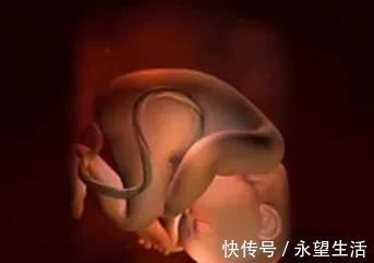 优质蛋白|35周胎儿在肚子里总是鼓包包,肚子发硬,吸收有点难受正常吗?