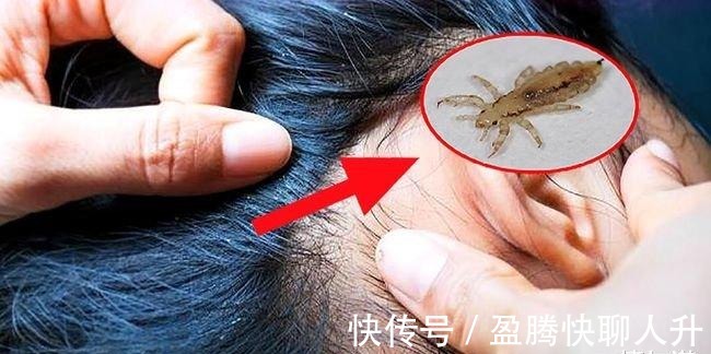 icu|女儿被妈妈用农药焗头驱虱进ICU，女人的无知比“农药”更可怕