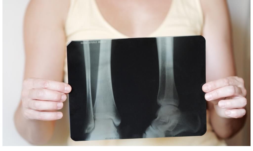 骨骼|吃一次相当于10斤豆腐,医生:你若天天吃,骨骼堪称“铁骨”