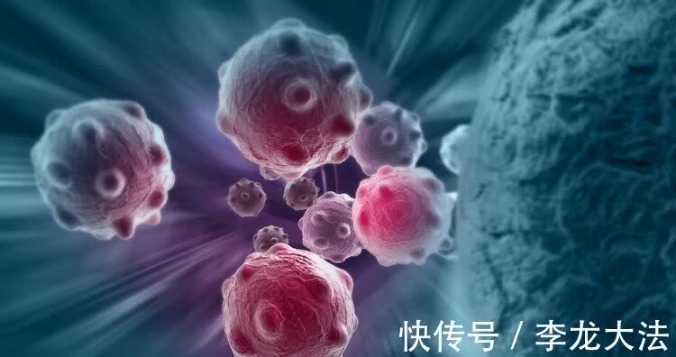 肺癌|癌症是如何转移的？好心提醒：癌症脑转移时，身体常有4种异常