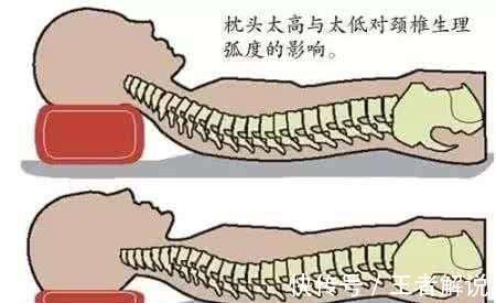 脊髓|什么是颈椎病，对照这些症状，看看你有没有中招