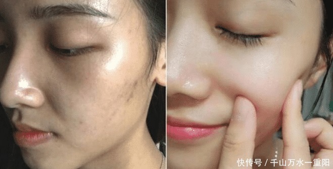 透明质酸钠|我国最“憋屈”精华液,明明有雅诗兰黛的品质,却被误认为是街货!