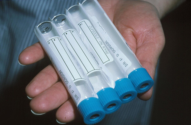 幽门螺杆菌“救星”,泡水喝一喝,养胃除菌,胃病自破