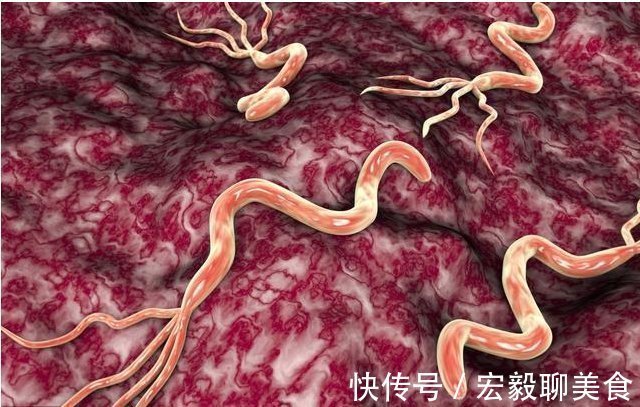 上皮细胞|幽门螺杆菌,中国人胃癌首害!医生提醒:积极预防,要做到这6点