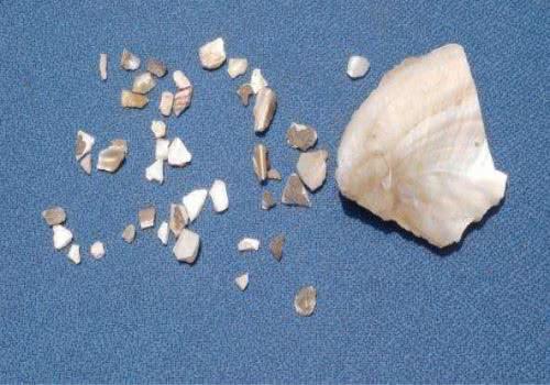 寿命|长期失眠寿命短!退休院长4物常吃,睡觉香甜寿命长!