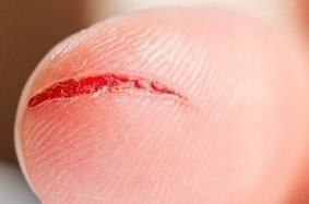 医院|身上出现这6个信号,尽快去医院检查一次肝功能,晚了就后悔吧