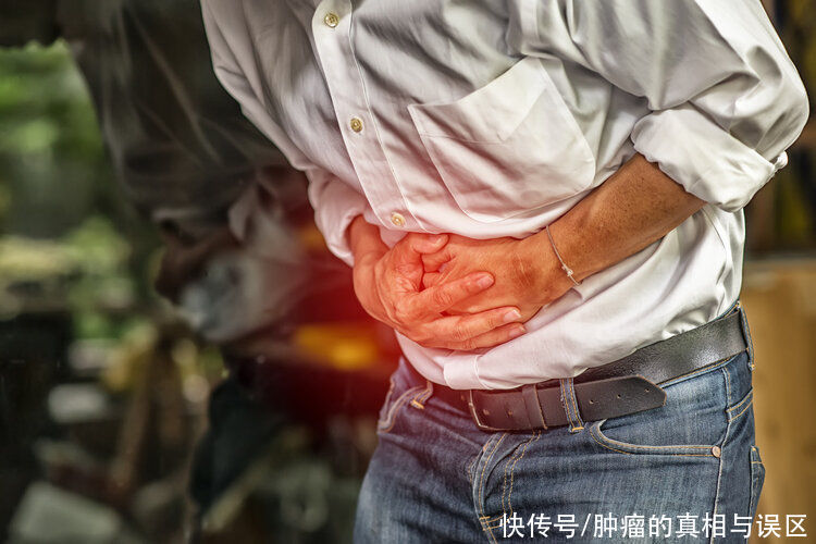 切除|你了解“造口人”吗？因为直肠癌，他们失去肛门，生存困境谁懂？