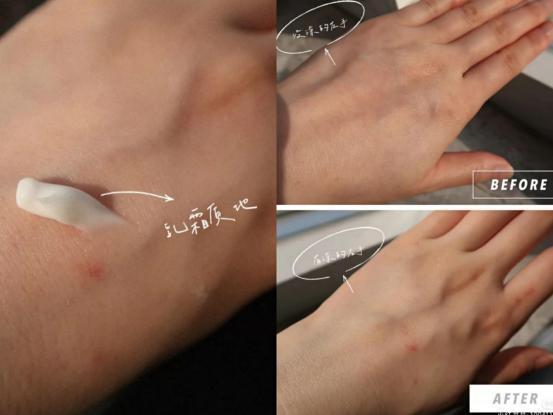 这些事|怀了两胎都没长妊娠纹？孕期三阶段做好这些事，花肚皮远离你