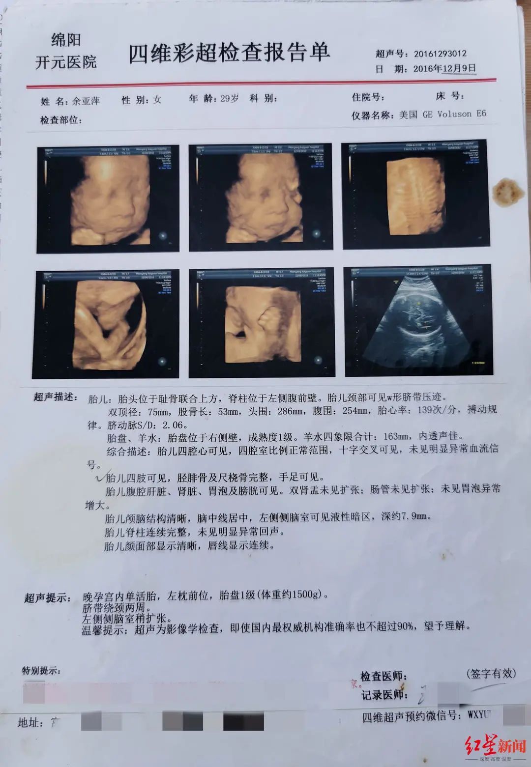 漏诊|产检四维彩超正常，孩子出生却左小腿畸形，医院漏诊赔偿百万