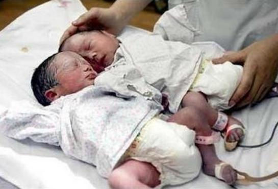 怀多胞胎|亲姐俩同天生下双胞胎，亲子鉴定确认，2对双胞胎的爸爸系同一人