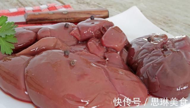 血管壁|血管堵塞“罪魁祸首”被揪出,专家提醒忌口2物,血管慢慢通畅
