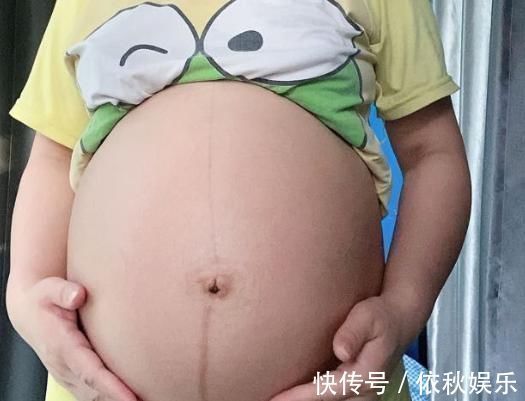 孕期|孕期肚子不见长,胎儿却查出偏大一周医生道出其中原因