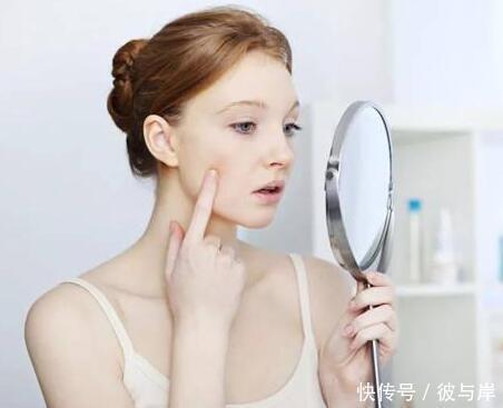 痘痘|总留痘印的人，会常常做这4件事，若你也在其中，请早点改掉