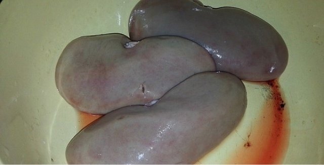 老公就馋这菜,长劲不长肉,下酒又下饭,隔三差五就要得吃!