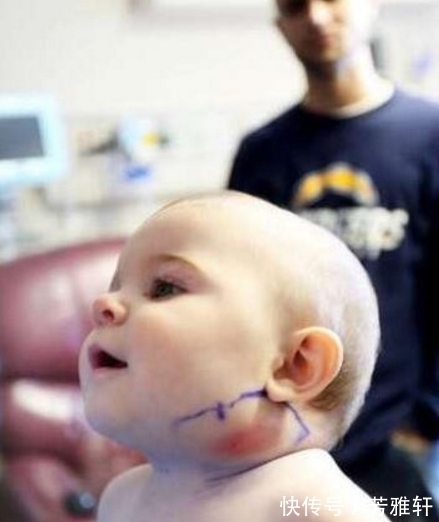 羽毛|妈妈发现宝宝脸上长出了一根羽毛,医生检查的结果吓坏妈妈