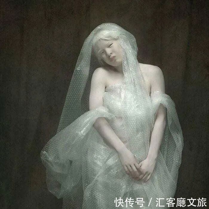 逆袭|因“全身雪白”被遗弃的中国女孩,逆袭成超模的故事让人泪目