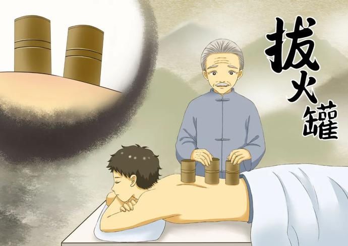 火罐|拔罐可以治什么病？这些误区要避开
