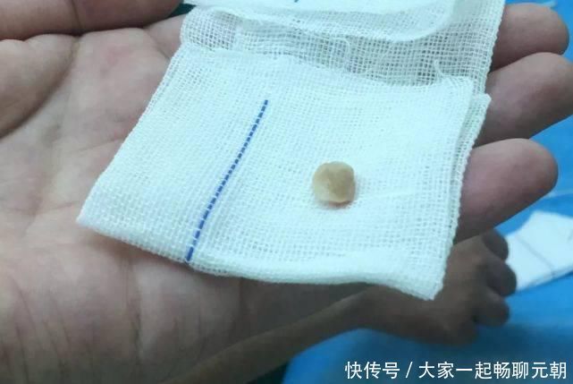 一个炒菜的功夫孩子就没了医生泣血忠告这些底线千万不要让孩子碰