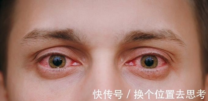 铁元素|肝脏好不好,看眼睛,春季养肝,老中医教你1招,预防肝硬化