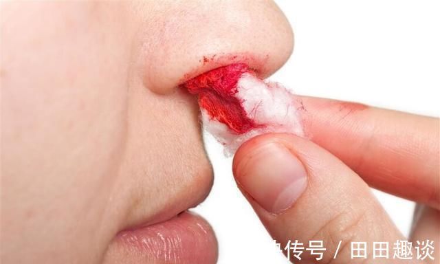 肝性脑病|一旦身体发出7个信号，十有八九是肝硬化，最好检查一下