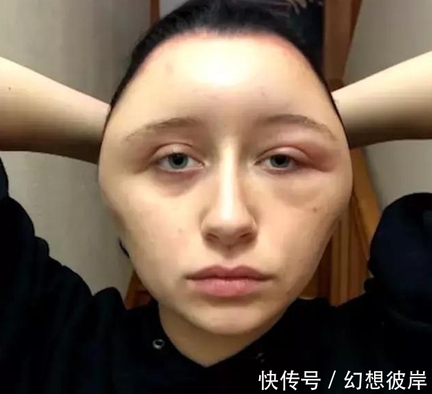 奇闻|奇闻:女孩自己动手染发变成“灯泡脸”,这就是美丽付出的代价