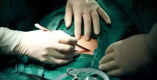 发动|男胎比女胎提前出生?这4类孕妈要小心,胎儿可能提前发动